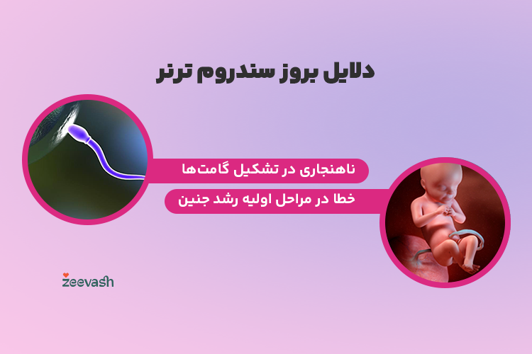 دلایل سندروم ترنر